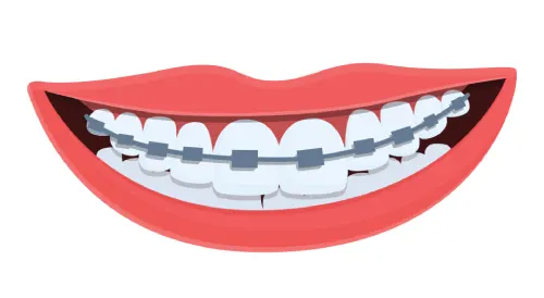 سیم دندان / ارتودنسی